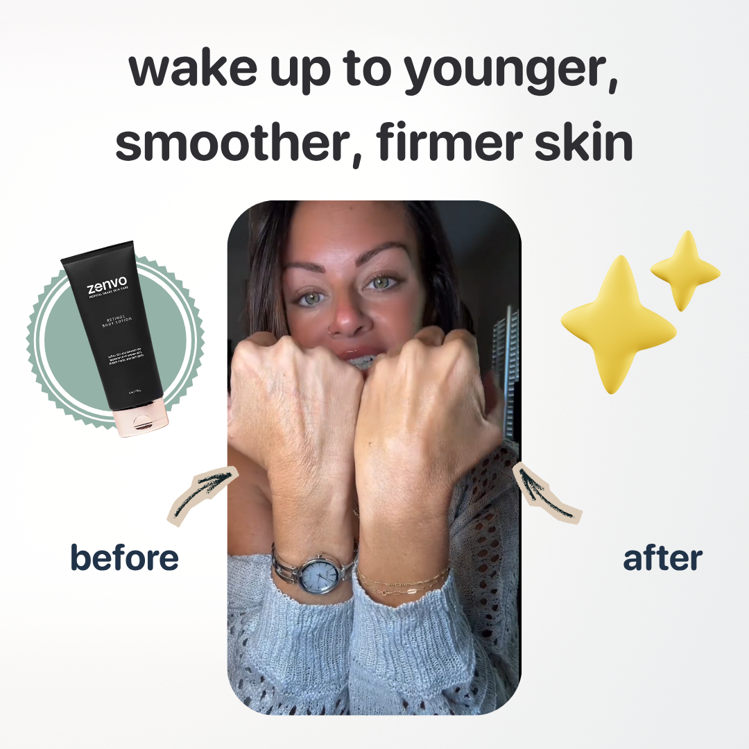 Retinol Body Lotion - Medical-Grade Formula for Younger-Looking Skin